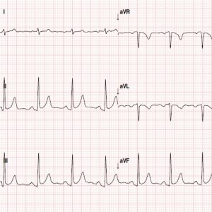 Cardiology